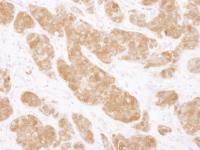 Detection of human COMT by immunohistoch