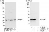 Detection of human COMT by western blot 