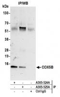 Detection of human COX5B by western blot