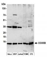 Detection of human and mouse COX5B by we
