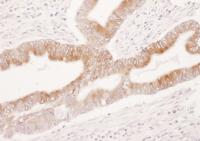 Detection of human COX-2 by immunohistoc