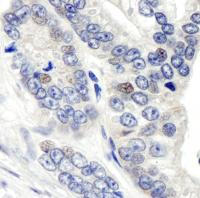 Detection of human CSN1 by immunohistoch