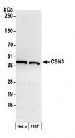 Detection of human CSN3 by western blot.