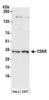 Detection of human CSN5 by western blot.