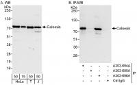 Detection of human Calnexin by western b