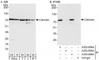 Detection of human and mouse Calnexin by