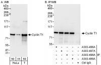 Detection of human Cyclin T1 by western 