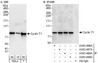 Detection of human Cyclin T1 by western 