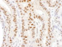 Detection of human DACH1 by immunohistoc