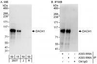 Detection of human DACH1 by western blot