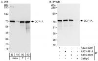 Detection of human DCP1A by western blot