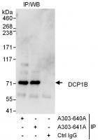 Detection of human DCP1B by western blot