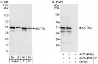 Detection of human DCTN2 by western blot