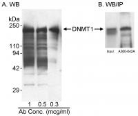 Detection of human DNMT1 by western blot
