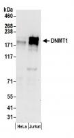 Detection of human DNMT1 by western blot