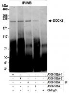 Detection of human DOCK9 by western blot