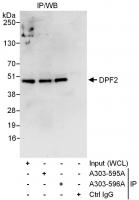 Detection of human DPF2 by western blot 