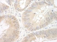 Detection of human EAF2 by immunohistoch