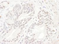 Detection of human ELK1 by immunohistoch