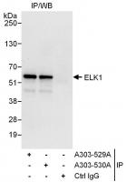 Detection of human ELK1 by western blot 