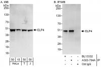 Detection of human ELP4 by western blot 