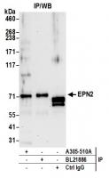 Detection of human EPN2 by western blot 