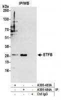 Detection of human ETFB by western blot 