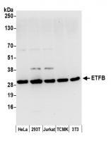Detection of human and mouse ETFB by wes