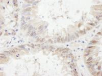 Detection of human ETV6 by immunohistoch