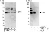 Detection of human ETV6 by western blot 