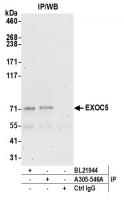 Detection of human EXOC5 by western blot