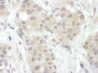 Detection of human FIH-1 by immunohistoc