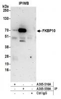 Detection of human FKBP10 by western blo