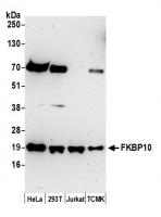 Detection of human and mouse FKBP10 by w