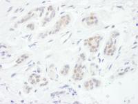 Detection of human FOXC1 by immunohistoc