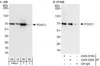 Detection of human FOXC1 by western blot