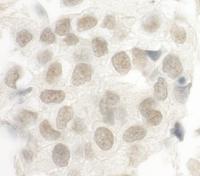 Detection of human FOXP1 by immunohistoc