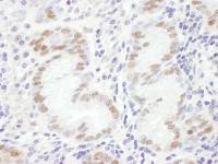 Detection of human GATA4 by immunohistoc