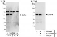 Detection of human GATA4 by western blot
