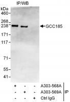 Detection of human GCC185 by western blo