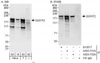 Detection of human GIGYF2 by western blo