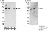 Detection of human GLI3 by western blot 