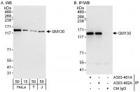 Detection of human GM130 by western blot