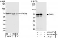 Detection of human GMEB2 by western blot