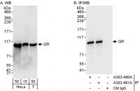 Detection of human GR by western blot an