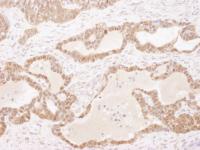 Detection of human GSTP1 by immunohistoc