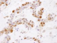 Detection of human GSTP1 by immunohistoc