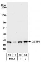 Detection of human GSTP1 by western blot