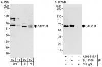 Detection of human GTF2H1 by western blo