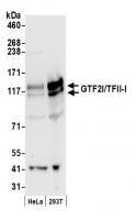 Detection of human GTF2I/TFII-I by weste